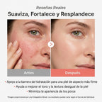 Mascarilla NÉCKA con PDRN