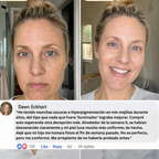 Mascarilla NÉCKA con PDRN