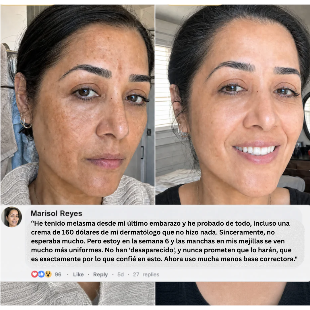 Mascarilla NÉCKA con PDRN