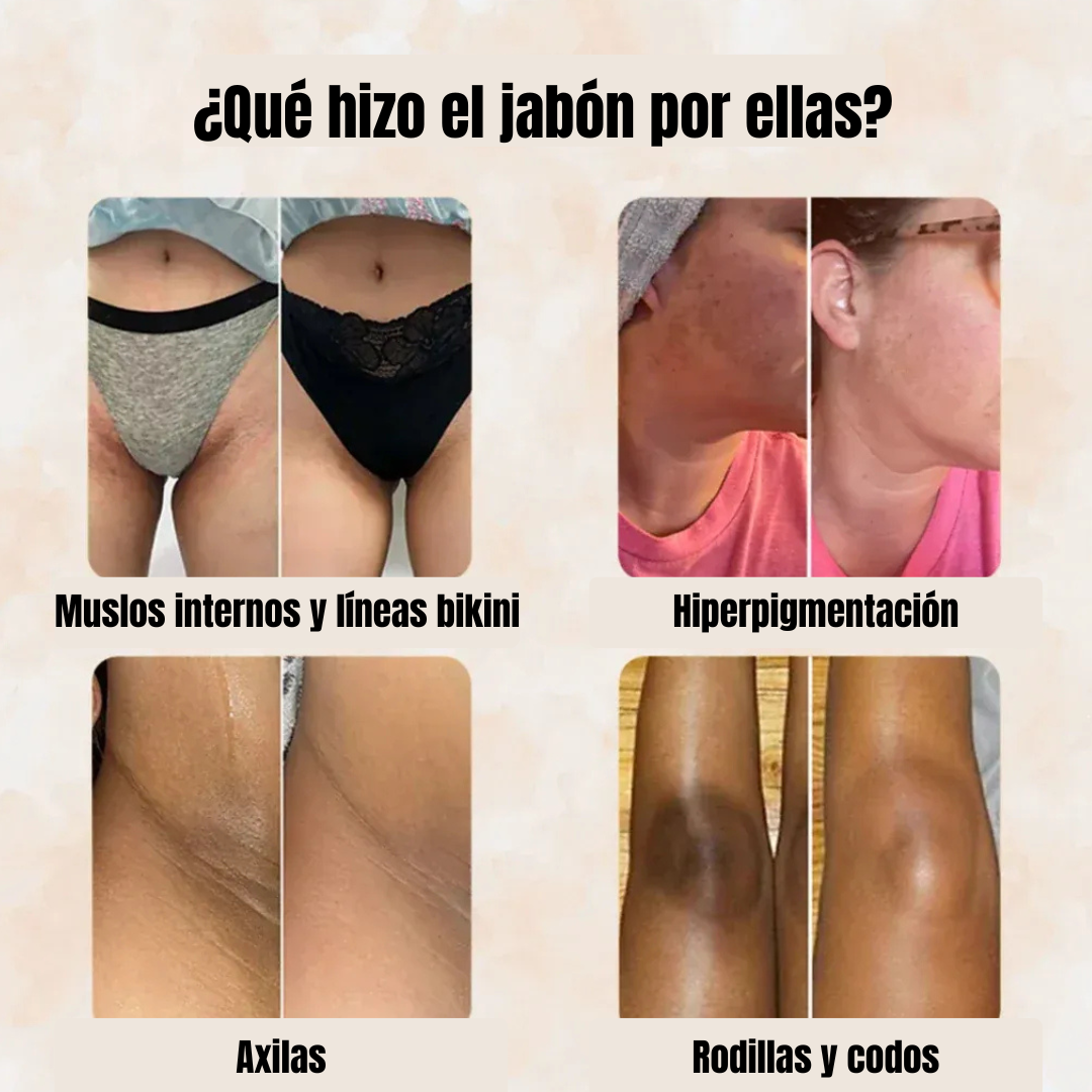JABÓN ILUMINADOR DE CÚRCUMA Y ÁCIDO KÓJICO